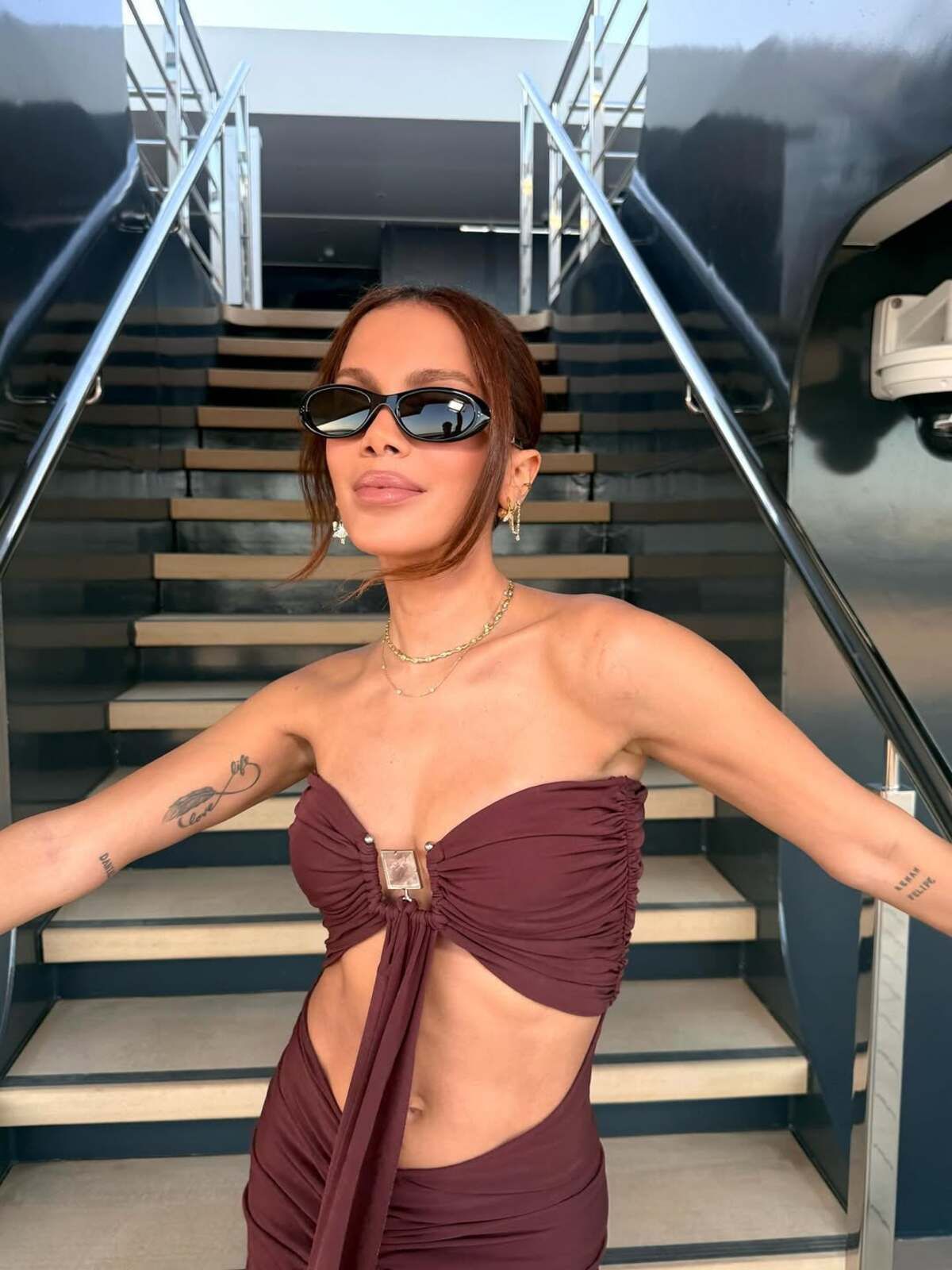Anitta passará por nova mudança radical após procedimentos estéticos: 'Tentar essa transição'