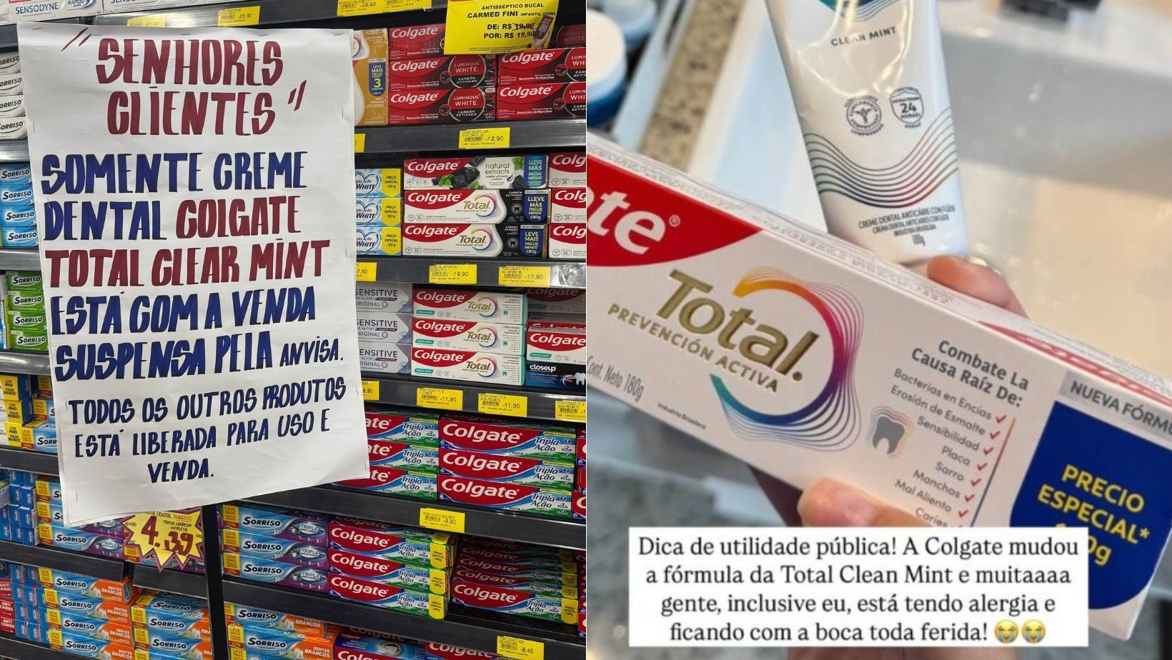 Anvisa mantém proibição de creme dental da Colgate após reações alérgicas; veja sintomas