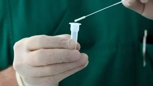 Ao todo, 3,7 mil testes foram comprados