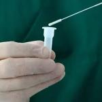 Secretaria de Saúde compra testes rápidos para detectar infecções por bactéria