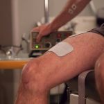 Síndrome de Guillain-Barré: entenda a doença que gerou estado de emergência no Peru