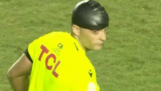 Árbitro Sávio Pereira Sampaio sofre corte na cabeça e apita Santos x Bahia com uma touca