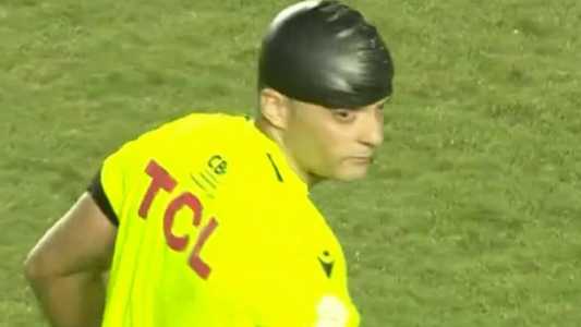 Árbitro Sávio Pereira Sampaio sofre corte na cabeça e apita Santos x Bahia com uma touca