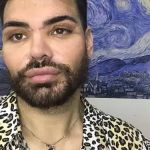 Ator passa por mais de 30 cirurgias para ficar parecido com Ricky Martin e quase perde a visão