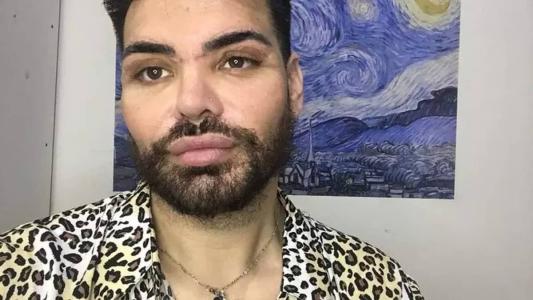 A vontade de parecer com o cantor surgiu depois de um reality onde perdeu 92kg