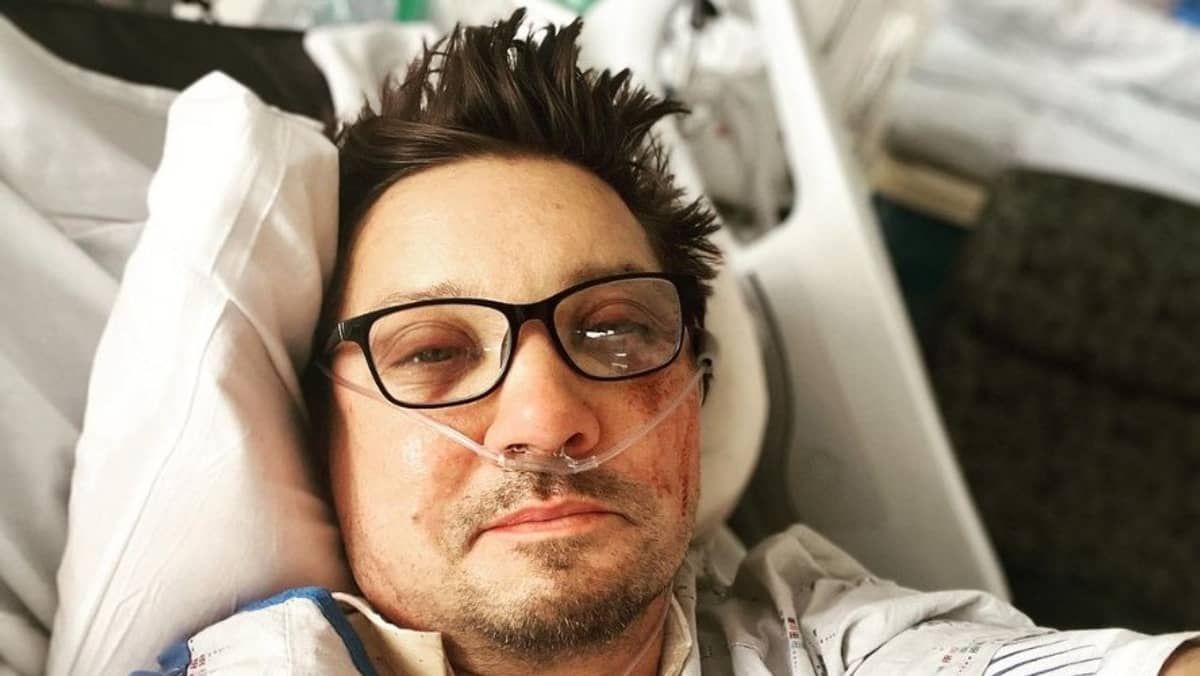 Jeremy Renner, o 'Gavião Arqueiro', foi atropelado por máquina de 14 toneladas 