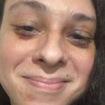 Ator Victor Meyniel posta foto do rosto seis dias depois de ser espancado