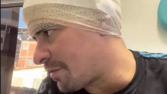 Ator sofreu acidente de trabalho