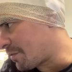 Thiago Martins sofre acidente durante gravação de Cidade de Deus