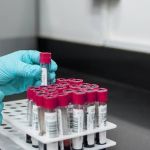 Anticorpos do sangue são usados para detectar bactéria causadora da hanseníase