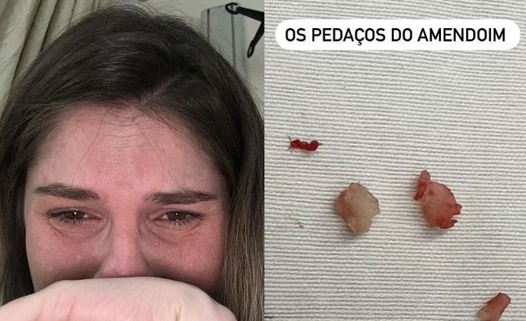 Filha de Bárbara Evans passa por cirurgia após comer amendoim e ter pulmão obstruído