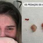 Filha de Bárbara Evans passa por cirurgia após comer amendoim e ter pulmão obstruído
