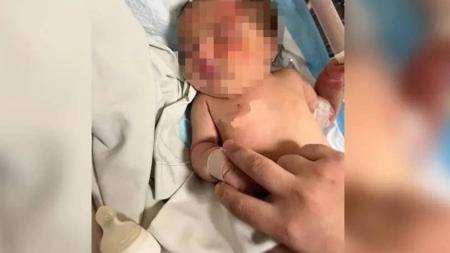 Bebê abandonada é encontrada em saco de lixo carregado por cachorro