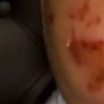 Bebê é encontrado com hematomas pelo corpo em creche, e mãe aciona a polícia em Luisburgo