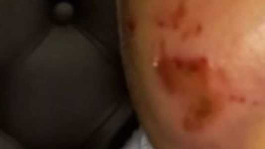 Bebê foi encontrado com vários hematomas