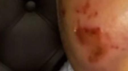 Bebê foi encontrado com vários hematomas