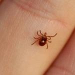 Bebê de 1 ano é o primeiro caso de febre maculosa em Congonhas