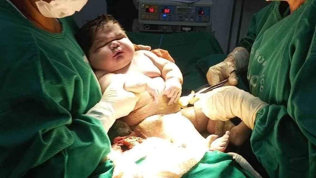 Bebê nasce com 7,3 quilos e quebra recorde no Amazonas