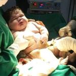 Bebê nasce com 7,3 quilos e quebra recorde no Amazonas