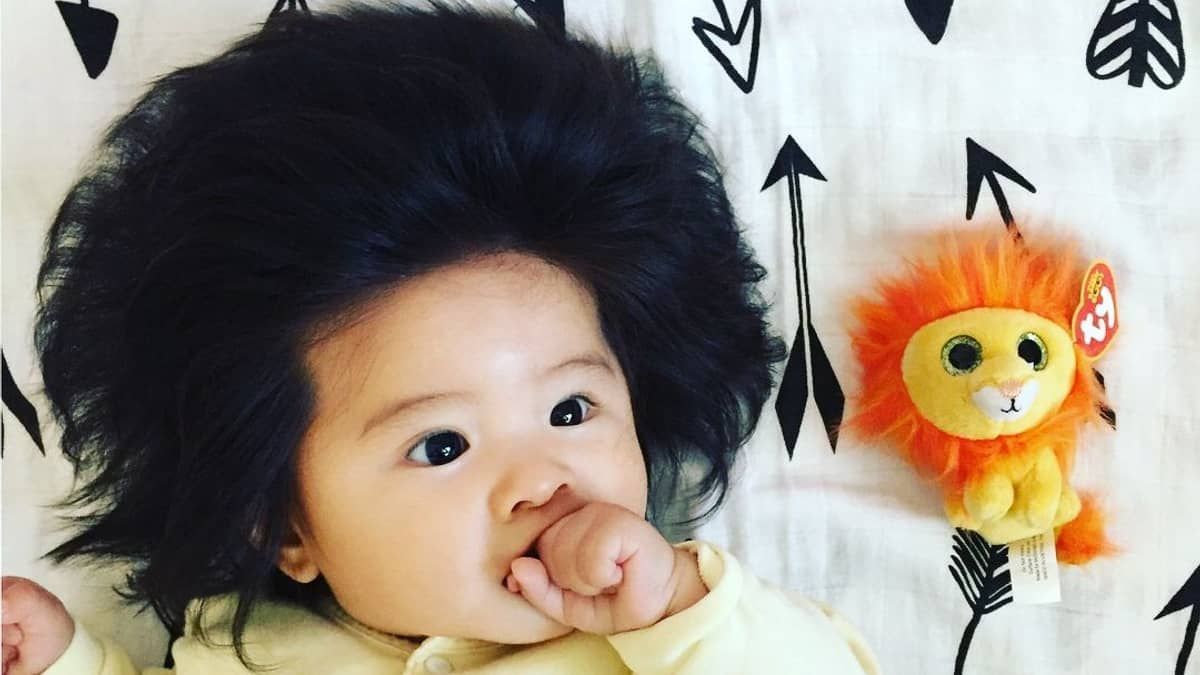 Bebê mais cabeluda do mundo tem 5 anos, e está irreconhecível