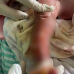 Recém-nascida do Acre internada em UTI após banho é transferida para Hospital João XXIII, em BH