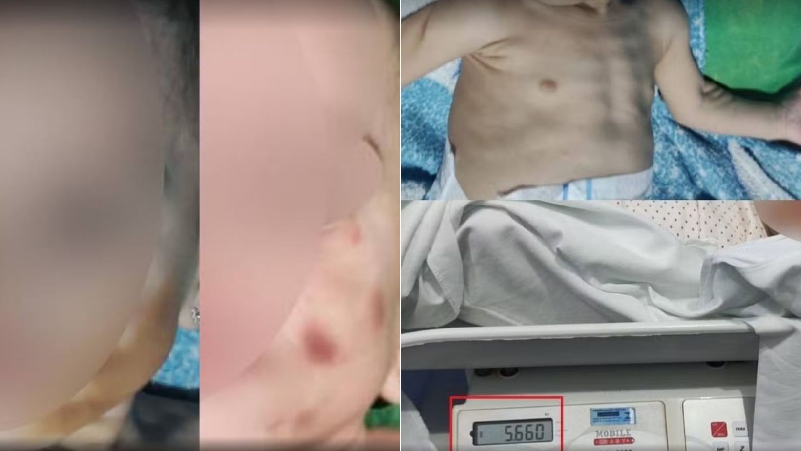 Mãe é presa por suspeita de maus-tratos após maquiar rosto de bebê para esconder hematomas