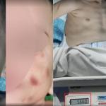 Mãe é presa por suspeita de maus-tratos após maquiar rosto de bebê para esconder hematomas
