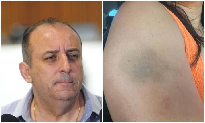 PC encaminha ao MP denúncia de ameaça e agressão envolvendo a ex-esposa de Wellington Magalhães