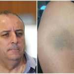 PC encaminha ao MP denúncia de ameaça e agressão envolvendo a ex-esposa de Wellington Magalhães