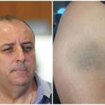 PC encaminha ao MP denúncia de ameaça e agressão envolvendo a ex-esposa de Wellington Magalhães