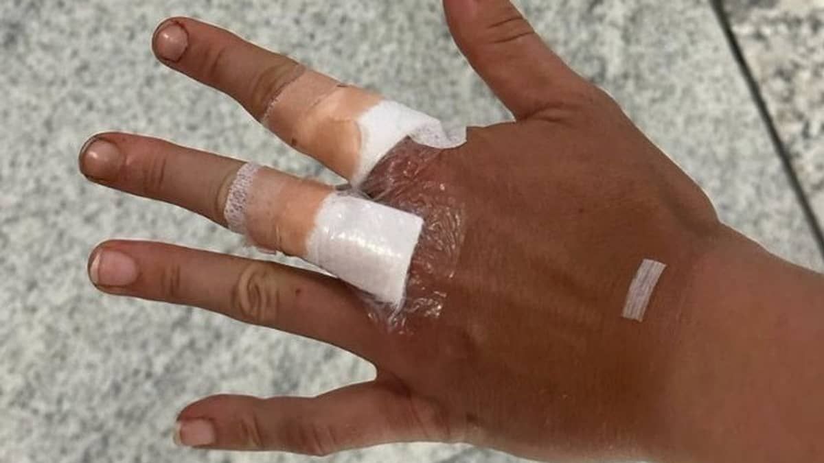 Bia Haddad sofre acidente doméstico, corta mãos e desiste de WTA de Guadalajara 