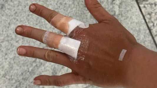Bia Haddad sofreu cortes na mão após box do banheiro quebrar