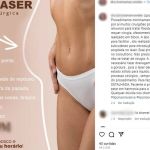 Biomédica mineira investigada por erros médicos oferta lipo na internet sem ter licença 