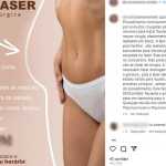 Biomédica mineira investigada por erros médicos oferta lipo na internet sem ter licença