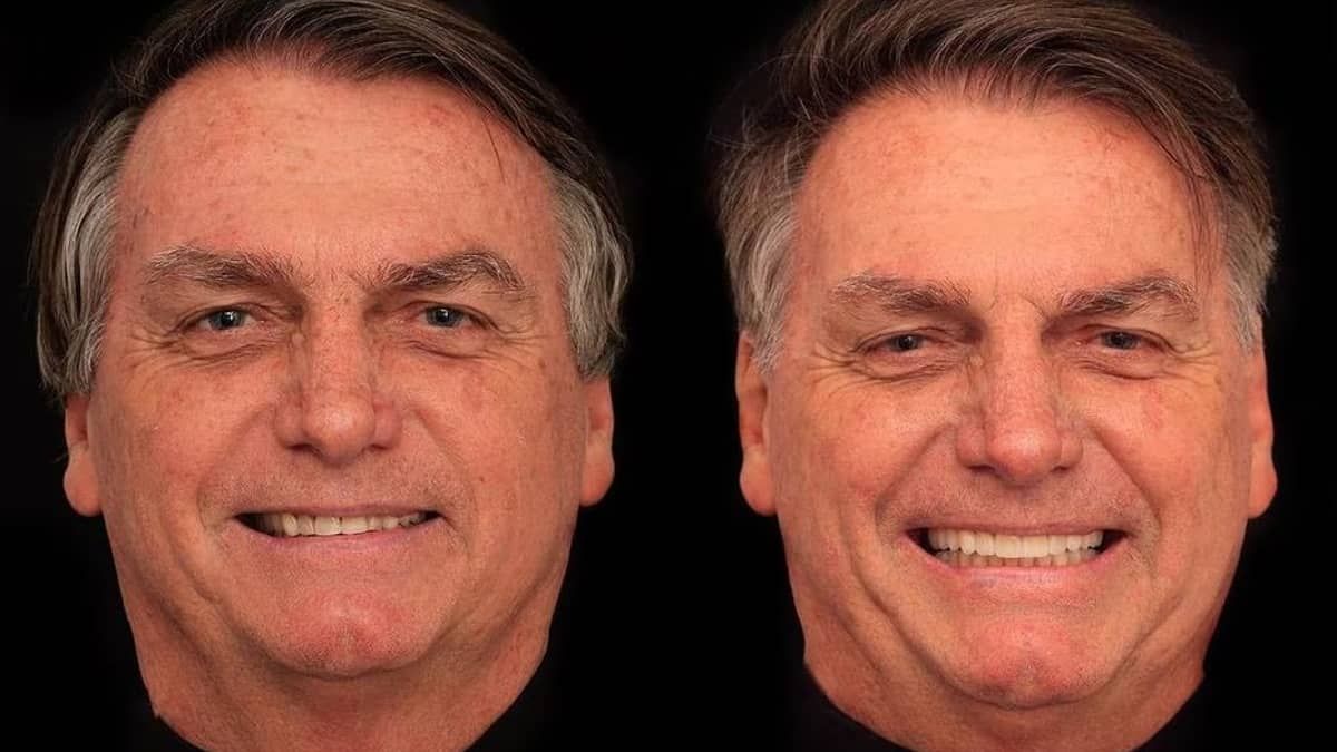 Bolsonaro faz harmonização facial em clínica de Goiânia e gasta R$ 84 mil