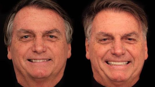 Bolsonaro fez harmonização facial em uma clínica localizada na capital goiana