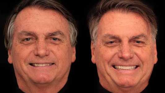Bolsonaro fez harmonização facial em uma clínica localizada na capital goiana