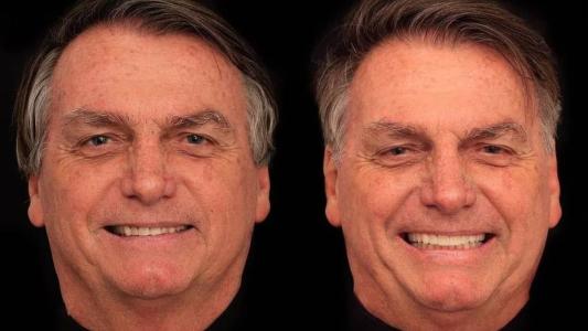 Bolsonaro fez harmonização facial em uma clínica localizada na capital goiana