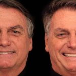 Bolsonaro faz harmonização facial em clínica de Goiânia e gasta R$ 84 mil