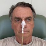 Bolsonaro inicia reabilitação após cirurgia e segue internado em Brasília