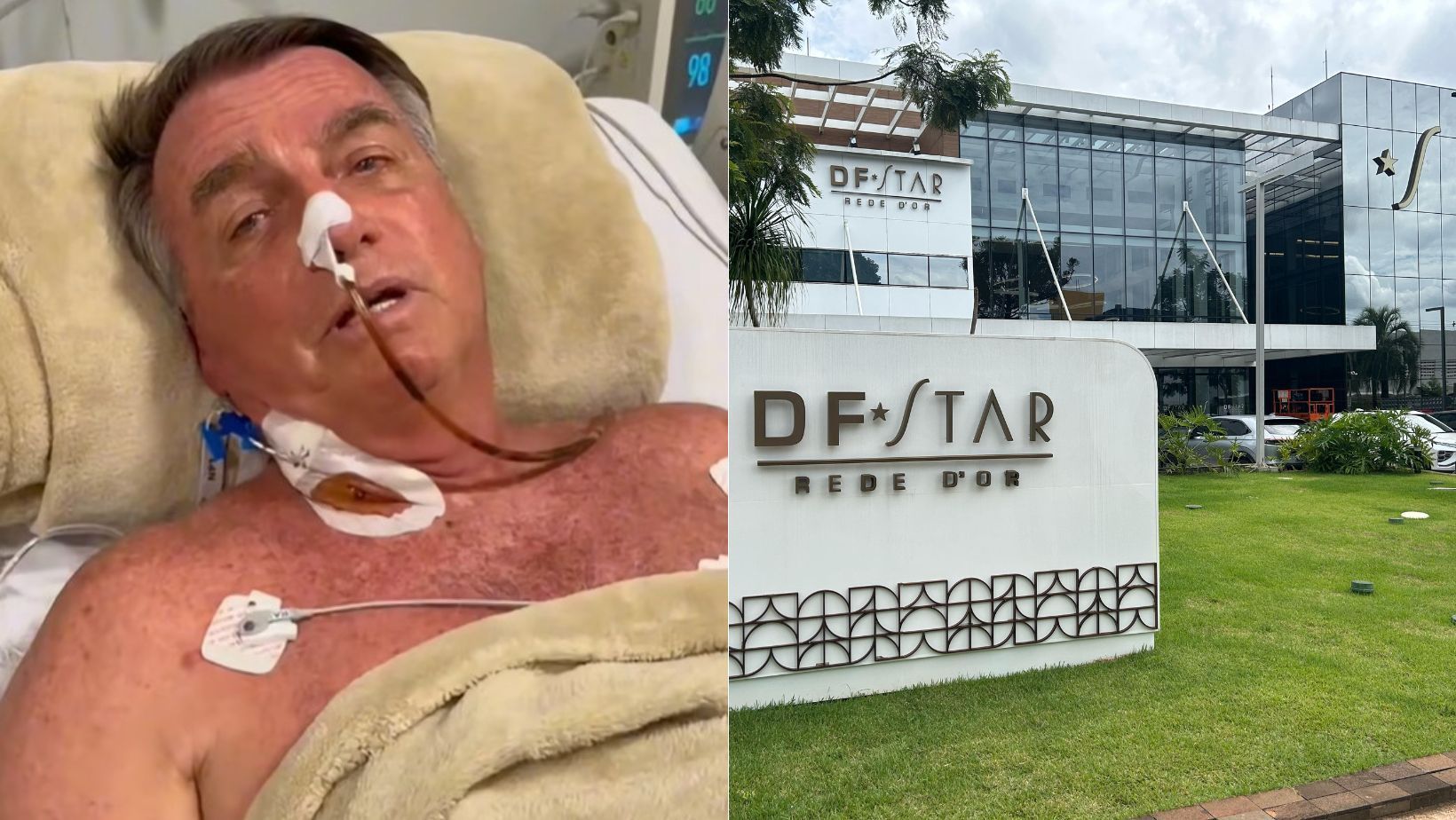 Bolsonaro internado: cirurgia do ex-presidente completa 10 horas de duração