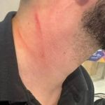 Xenofobia: brasileiro denuncia ter sido agredido por português em shopping