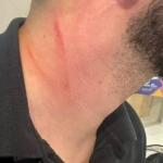 Xenofobia: brasileiro denuncia ter sido agredido por português em shopping