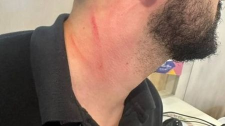 Brasileiro foi agredido em loja que trabalha