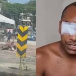 Vídeo: motorista que perdeu olho após ser baleado por cabo da PM em BH faz vaquinha