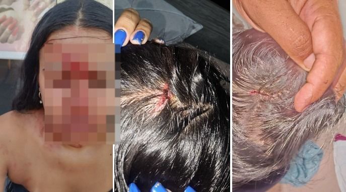 Discordância sobre tratamento de cabelo termina em agressão entre advogada e cabeleireira em BH