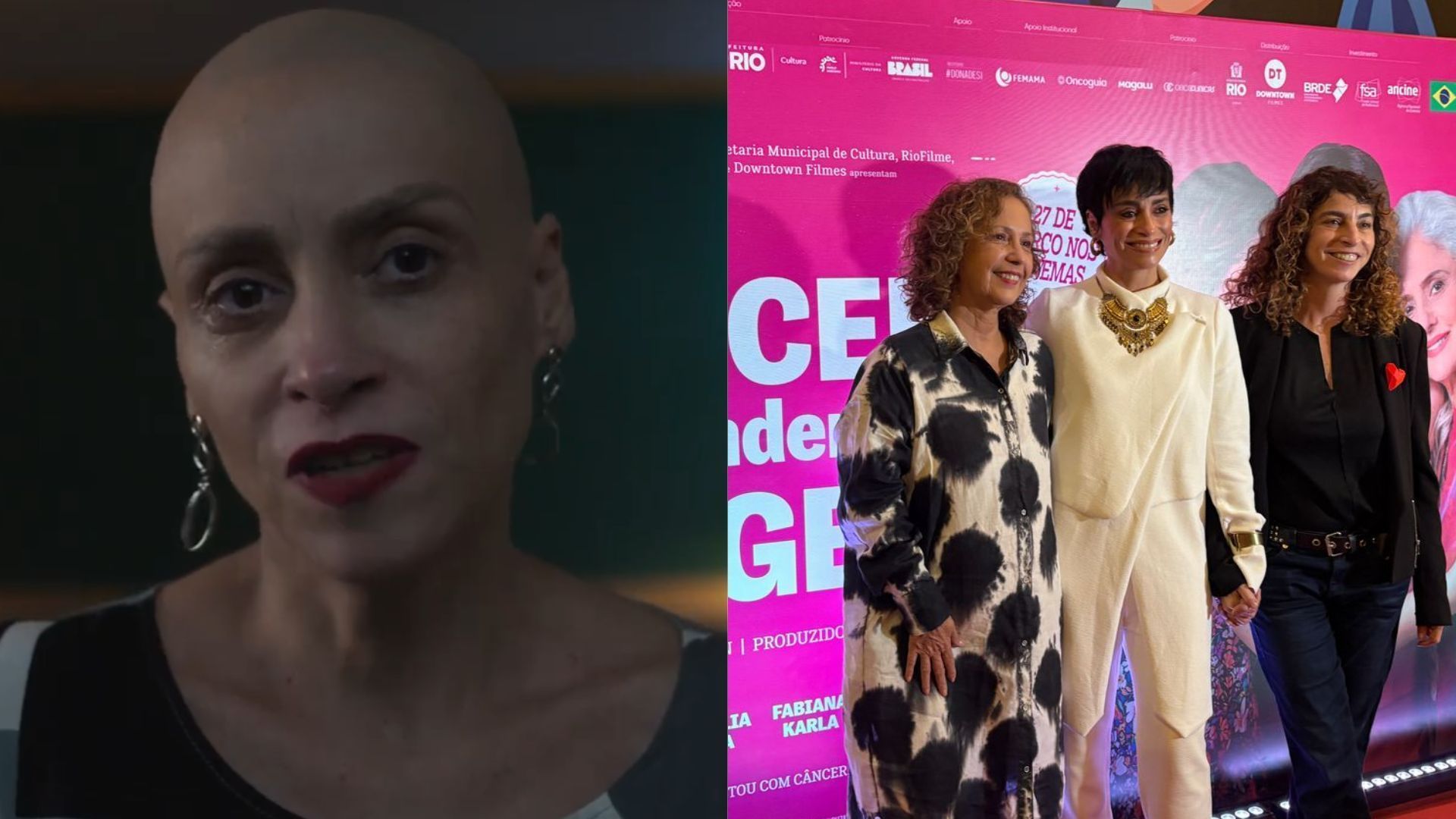 Suzana Pires raspa cabelo para viver personagem com câncer e faz revelação emocionante