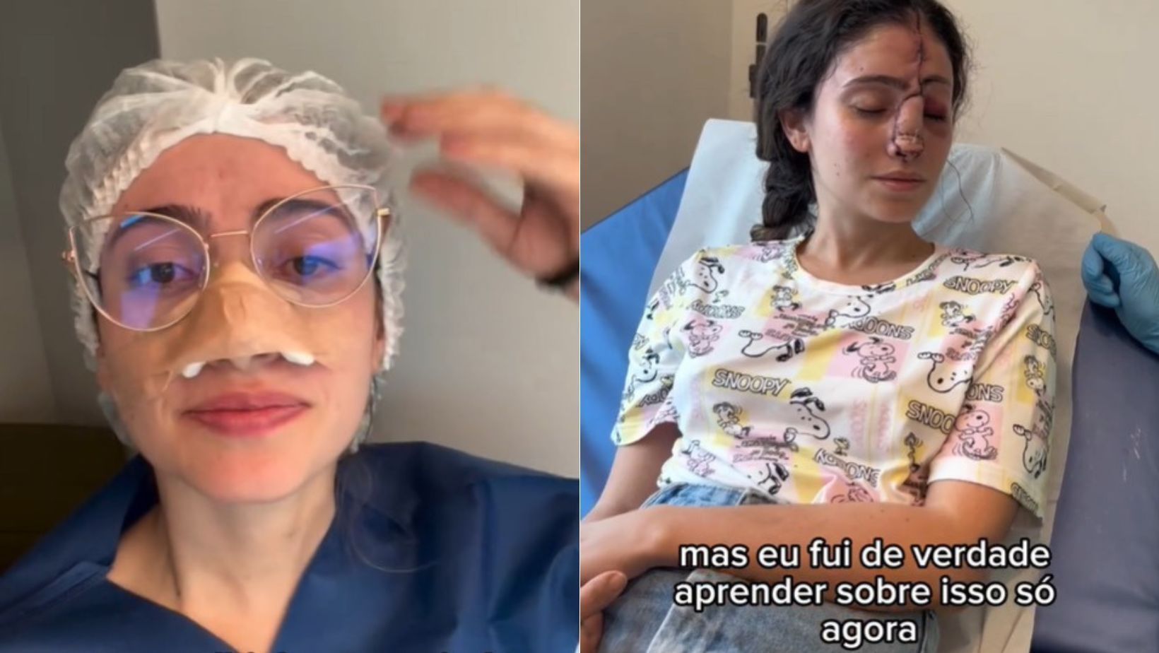 Empresária é diagnosticada com sarcoma no nariz, um tipo raro de câncer: 'Minha ficha demorou a cair'