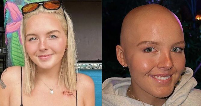 TikToker com câncer terminal, que compartilhou seu dia a dia nas redes sociais, morre aos 26 anos