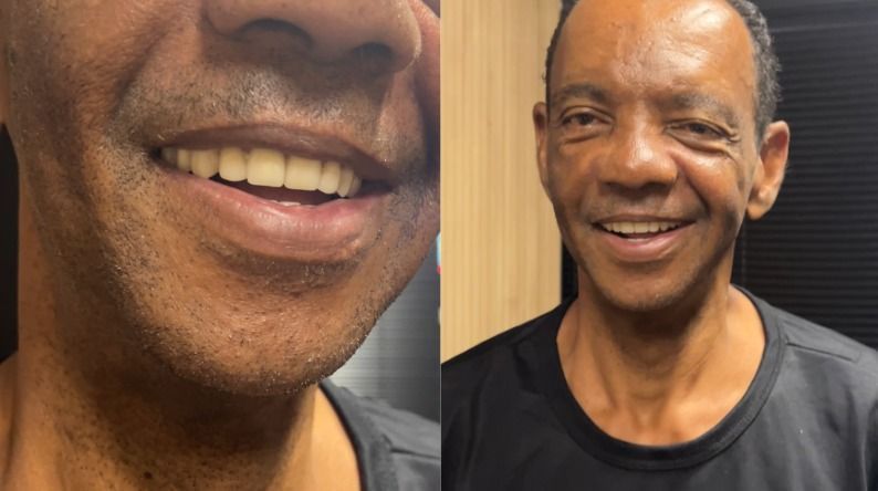 Cantor de BH que perdeu todos os dentes em acidente ganha implante: ‘mudou minha vida’
